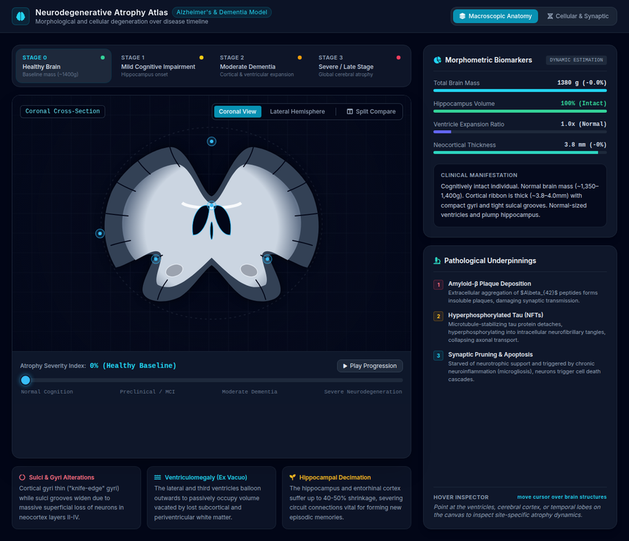 Brain Atrophy in Dementia — Interactive HTML Visualization visual preview